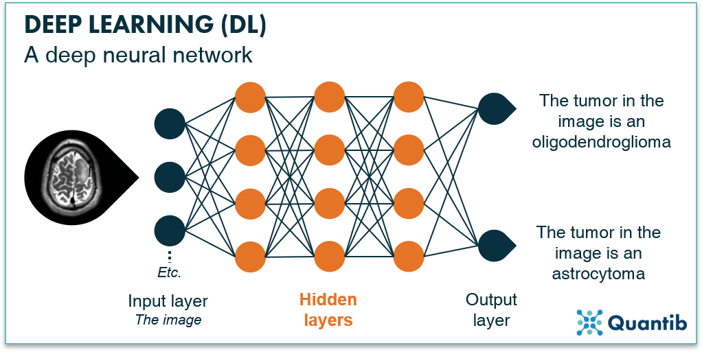 how-does-deep-learning-in-radiology-work